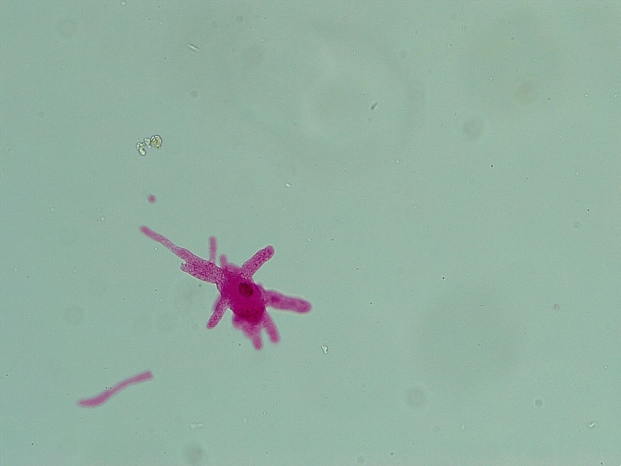 Amoeba