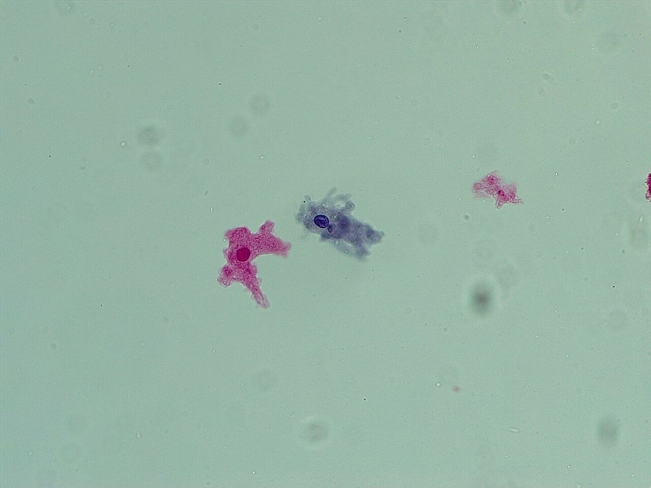 Amoeba
