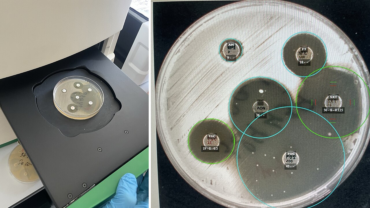 Antibiotic sensitivity testing