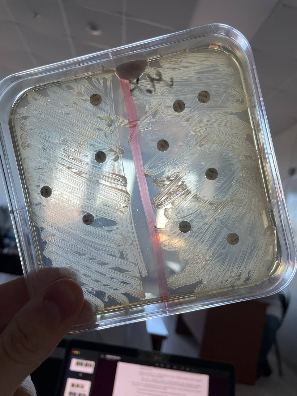Antibiotic sensitivity testing