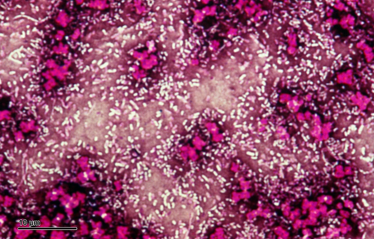 Bacterial capsule