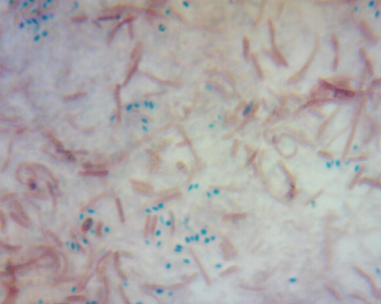 Endospore