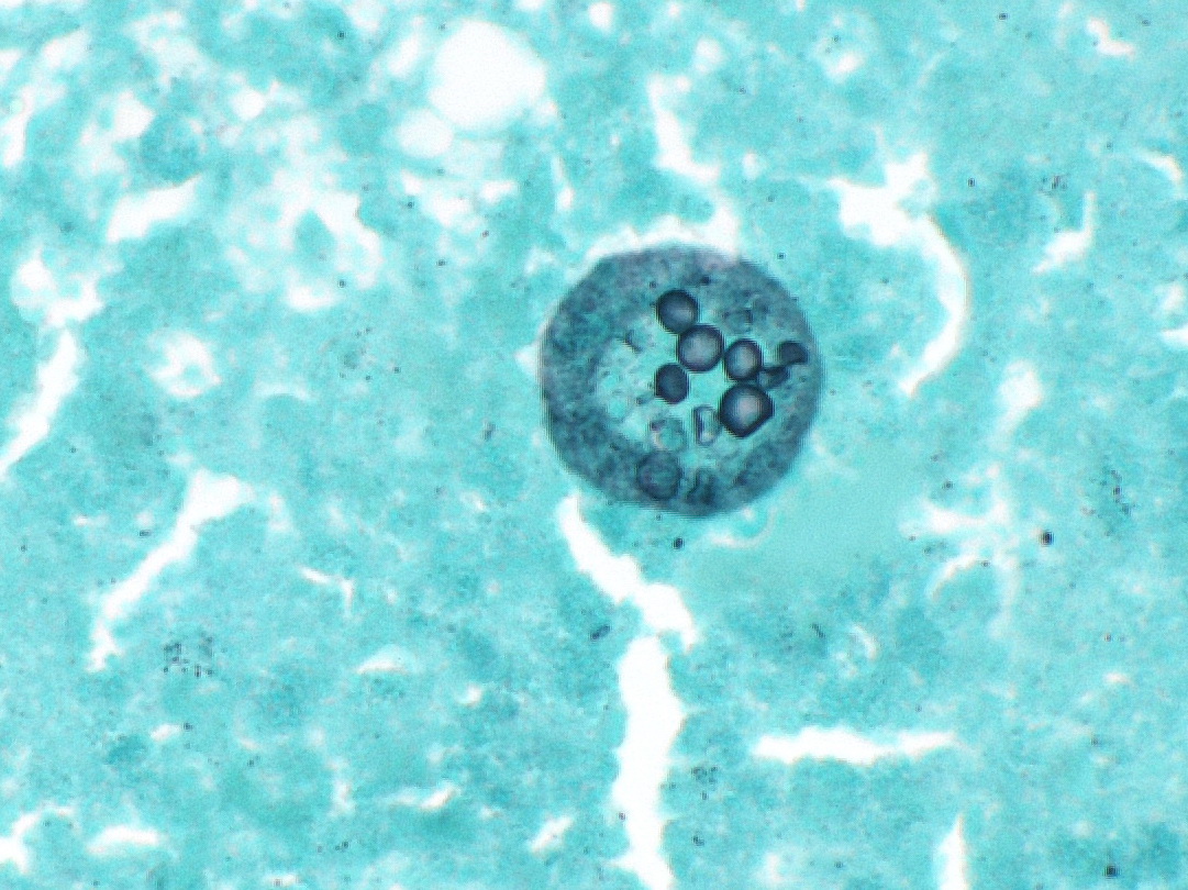 Endospore