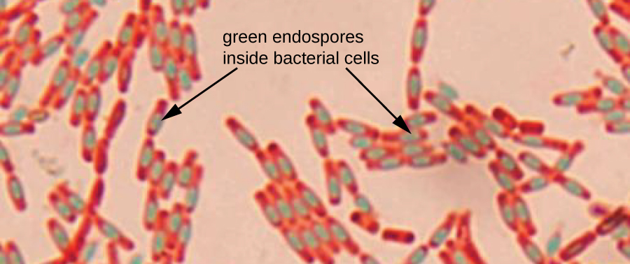 Endospore staining
