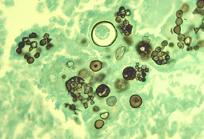 Endospore staining